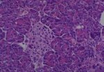 Thumbnail_Novus Biologicals Human Multi-tissue Tissue MicroArray (Cancer) Human Ovary