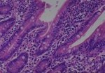 Thumbnail_Novus Biologicals Human Multi-tissue Tissue MicroArray (Cancer) Human Ovary