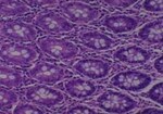 Thumbnail_Novus Biologicals Human Multi-tissue Tissue MicroArray (Cancer) Human Ovary