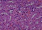 Thumbnail_Novus Biologicals Human Multi-tissue Tissue MicroArray (Cancer) Human Ovary