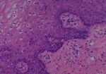 Thumbnail_Novus Biologicals Human Multi-tissue Tissue MicroArray (Cancer) Human Ovary