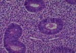 Thumbnail_Novus Biologicals Human Multi-tissue Tissue MicroArray (Cancer) Human Ovary