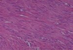Thumbnail_Novus Biologicals Human Multi-tissue Tissue MicroArray (Cancer) Human Ovary