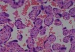 Thumbnail_Novus Biologicals Human Multi-tissue Tissue MicroArray (Cancer) Human Ovary