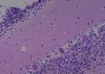 Thumbnail_Novus Biologicals Human Multi-tissue Tissue MicroArray (Cancer) Human Ovary