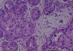 Thumbnail_Novus Biologicals Human Multi-tissue Tissue MicroArray (Cancer) Human Ovary