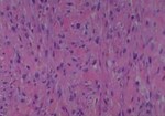 Thumbnail_Novus Biologicals Human Multi-tissue Tissue MicroArray (Cancer) Human Ovary