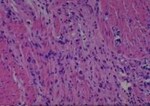 Thumbnail_Novus Biologicals Human Multi-tissue Tissue MicroArray (Cancer) Human Ovary