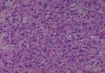 Thumbnail_Novus Biologicals Human Multi-tissue Tissue MicroArray (Cancer) Human Ovary