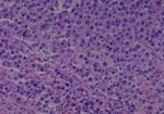 Thumbnail_Novus Biologicals Human Multi-tissue Tissue MicroArray (Cancer) Human Ovary
