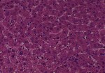 Thumbnail_Novus Biologicals Human Multi-tissue Tissue MicroArray (Cancer) Human Ovary