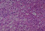 Thumbnail_Novus Biologicals Human Multi-tissue Tissue MicroArray (Cancer) Human Ovary