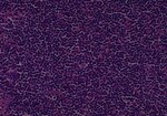 Thumbnail_Novus Biologicals Human Multi-tissue Tissue MicroArray (Cancer) Human Ovary