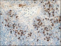 Lambda Light Chain Antibody (K22-Y), Novus Biologicals:Antibodies:Primary