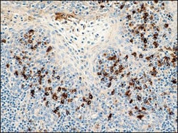 Lambda Light Chain Antibody (K22-Y), Novus Biologicals:Antibodies:Primary