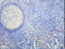 Lambda Light Chain Antibody (K22-Y), Novus Biologicals:Antibodies:Primary