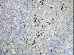 Lambda Light Chain Antibody (K22-Y), Novus Biologicals:Antibodies:Primary