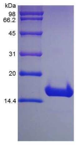 Novus Biologicals Recombinant Human p16INK4a/CDKN2A Protein 100 &mu;g | Buy Online | Novus Biologicals&trade; | Fisher Scientific