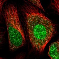 Huntingtin Antibody, Novus Biologicals:Antibodies:Primary Antibodies