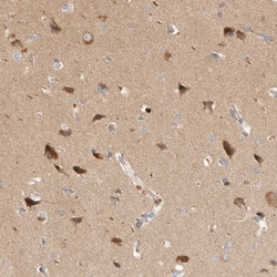 Huntingtin Antibody, Novus Biologicals:Antibodies:Primary Antibodies