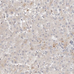 Huntingtin Antibody, Novus Biologicals:Antibodies:Primary Antibodies