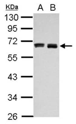Hyaluronan Synthase 3/HAS3 Antibody, Novus Biologicals 0.1 mL | Buy Online | Novus Biologicals | Fisher Scientific