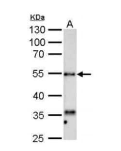 Hyaluronidase 1/HYAL1 Antibody, Novus Biologicals 0.1mL; Unlabeled:Antibodies,