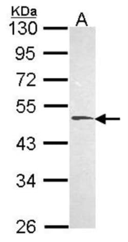 Hyaluronidase 1/HYAL1 Antibody, Novus Biologicals 0.1mL; Unlabeled:Antibodies,