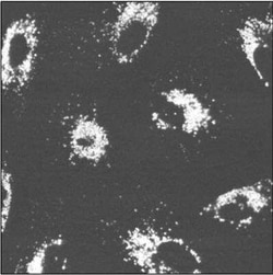 Novus Biologicals HypoxiTRAK(TM) 500 &mu;L | Buy Online | Novus Biologicals&trade; | Fisher Scientific