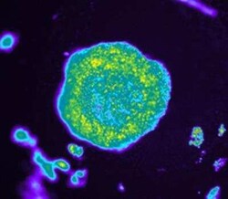 Novus Biologicals HypoxiTRAK(TM) 500 &mu;L | Buy Online | Novus Biologicals&trade; | Fisher Scientific