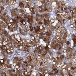 IA-2/PTPRN Antibody, Novus Biologicals:Antibodies:Primary Antibodies