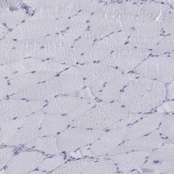 IA-2/PTPRN Antibody, Novus Biologicals:Antibodies:Primary Antibodies