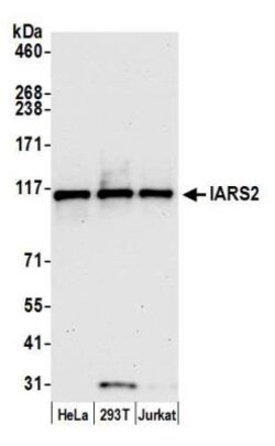 IARS2 Rabbit anti-Human, Polyclonal, Novus Biologicals 100&mu;L; Unlabeled:Antibodies,