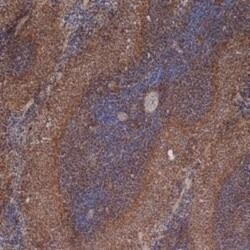 ICAM-1/CD54 Antibody (1A29), Novus Biologicals 0.1mg; Unlabeled:Antibodies,