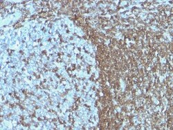 ICAM-3/CD50 Antibody (ICAM3/1019), Novus Biologicals 0.2mg; Unlabeled:Antibodies,
