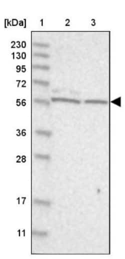 ICB1 Antibody, Novus Biologicals 25 &mu;L | Buy Online | Novus Biologicals | Fisher Scientific