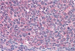 ICOS Antibody, Novus Biologicals 0.1mg; Unlabeled:Antibodies, Polyclonal