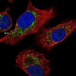IDH3B Antibody, Novus Biologicals 0.1mL; Unlabeled:Antibodies, Polyclonal