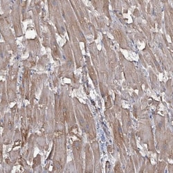 IDH3B Antibody, Novus Biologicals 0.1mL; Unlabeled:Antibodies, Polyclonal