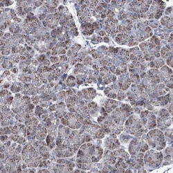IDH3B Antibody, Novus Biologicals 0.1mL; Unlabeled:Antibodies, Polyclonal