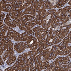 IDH3B Antibody, Novus Biologicals 0.1mL; Unlabeled:Antibodies, Polyclonal