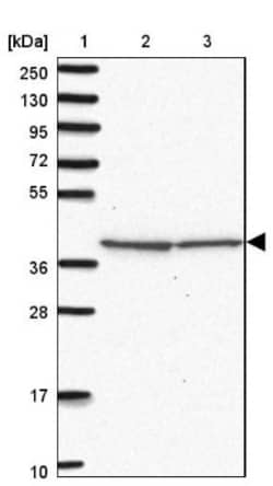 IDH3B Antibody, Novus Biologicals 0.1mL; Unlabeled:Antibodies, Polyclonal