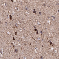 IDH3G Antibody, Novus Biologicals 25 &mu;L; Unlabeled:Antibodies, Polyclonal