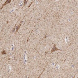 IDH3G Antibody, Novus Biologicals 0.1mL; Unlabeled:Antibodies, Polyclonal