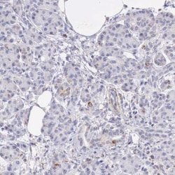 IDH3G Antibody, Novus Biologicals 0.1mL; Unlabeled:Antibodies, Polyclonal