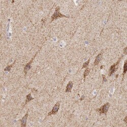 IDH3G Antibody, Novus Biologicals 0.1mL; Unlabeled:Antibodies, Polyclonal