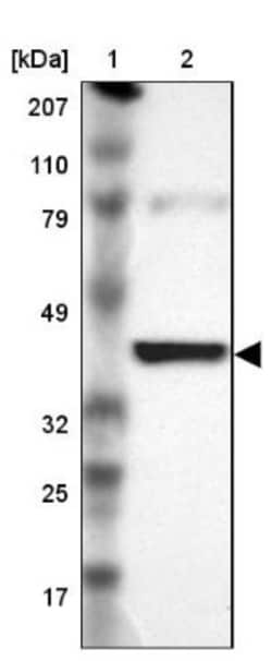 IDH3G Antibody, Novus Biologicals 25 &mu;L; Unlabeled:Antibodies, Polyclonal