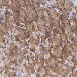 IF3EI Antibody, Novus Biologicals 25 &mu;L; Unlabeled:Antibodies, Polyclonal