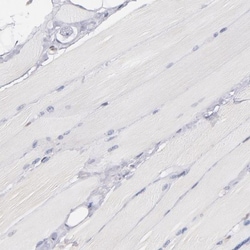IFI16 Antibody, Novus Biologicals:Antibodies:Primary Antibodies