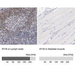 IFI16 Antibody, Novus Biologicals:Antibodies:Primary Antibodies